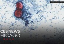 Explosive Diarrhea Hits Taco Bell Source: Cyclospora outbreak tied to lettuce served at some Taco Bell restaurants